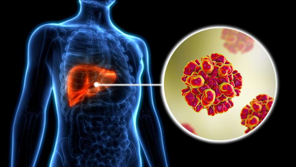 World Hepatitis Day 2025: Urgent Call to Tackle Europe's Health Crisis